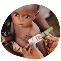 Malnutrition2