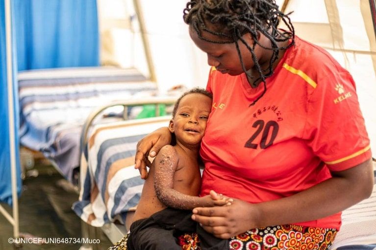 Floride, the mother of one-and-a-half-year-old Amie-Grâce, holds her child, who is affected by Mpox. Amie-Grâce is being treated at the Mpox care center of the Prince Louis Rwagasore Clinic in Burundi.