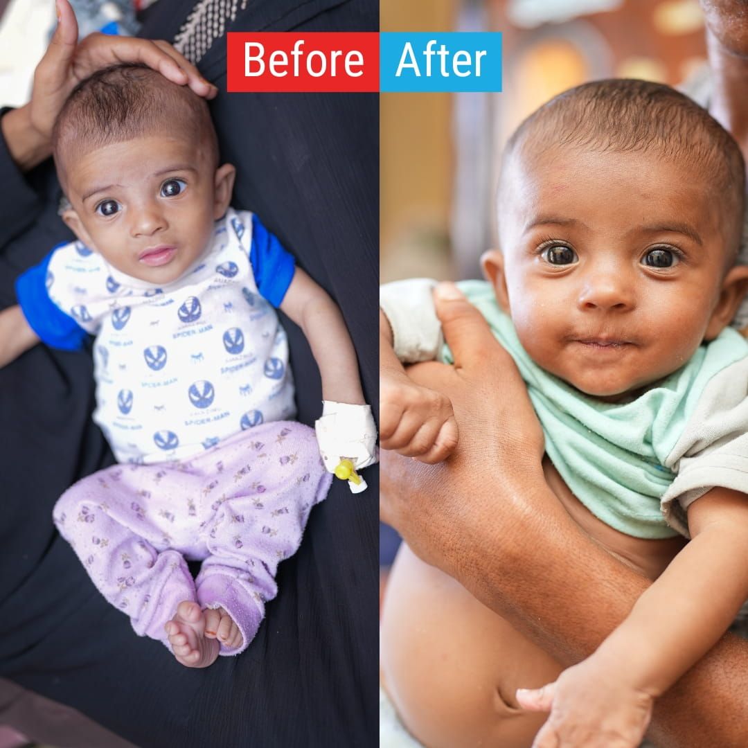 Donate today to help more children recover
