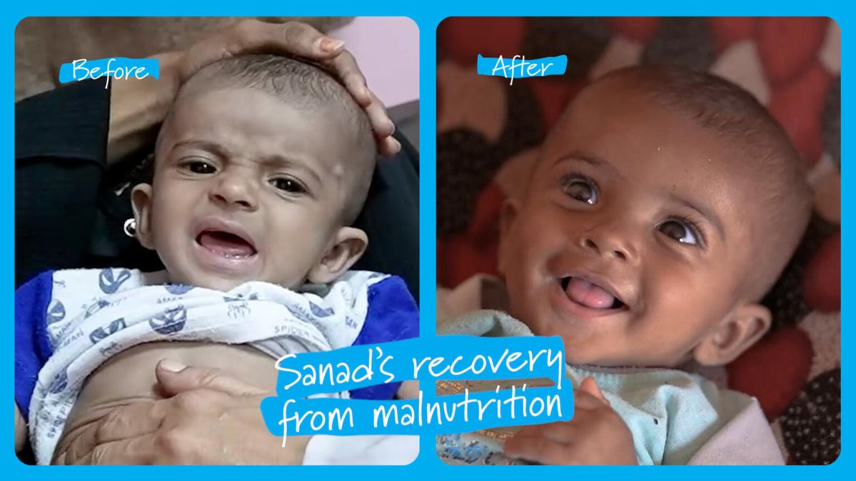 sanad before-after
