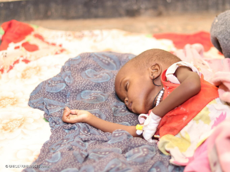Child malnutrition crisis in Sudan.