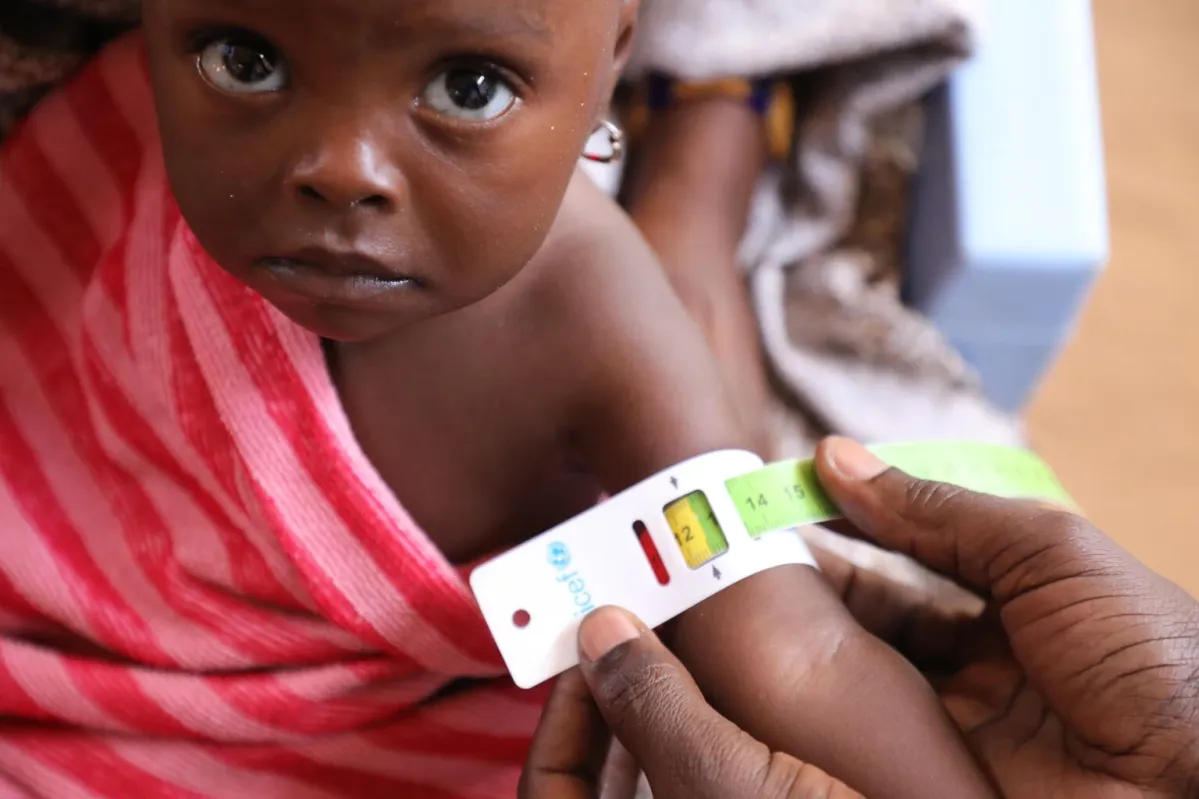 Child receiving treatment for malnutrition