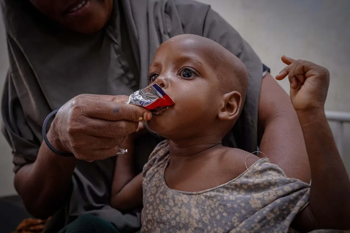 Child eating RUFT