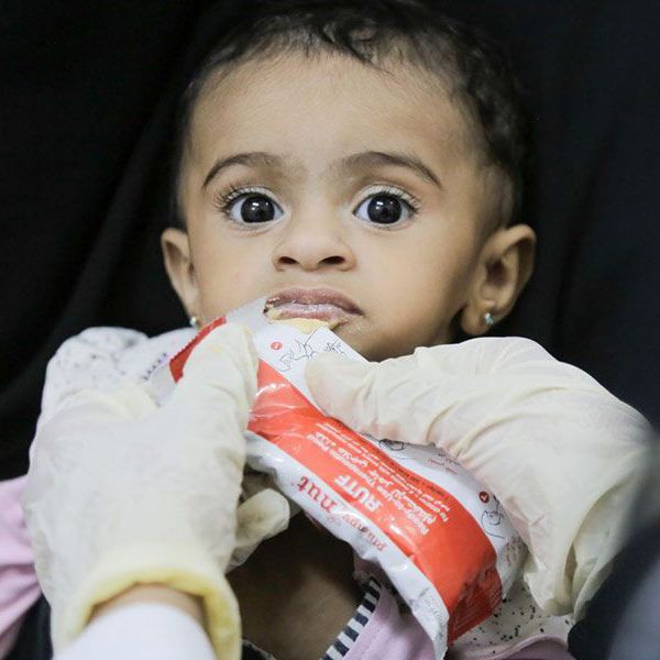 7-month-old Imetanan Taha receives therapeutic food to help her fight malnourishment