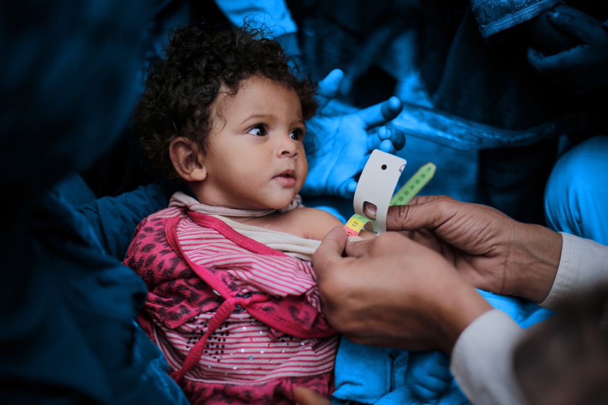 Child getting MUAC at UNICEF supported facility